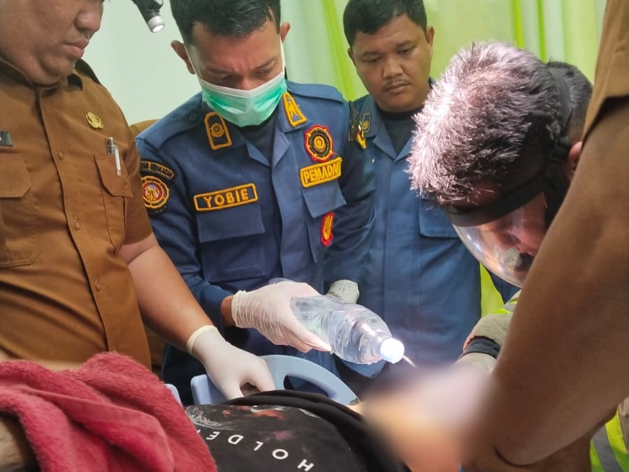 Indo Bokep Cincin Nyangkut di Kemaluan, Pria di Pekanbaru Minta Donasi Damkar