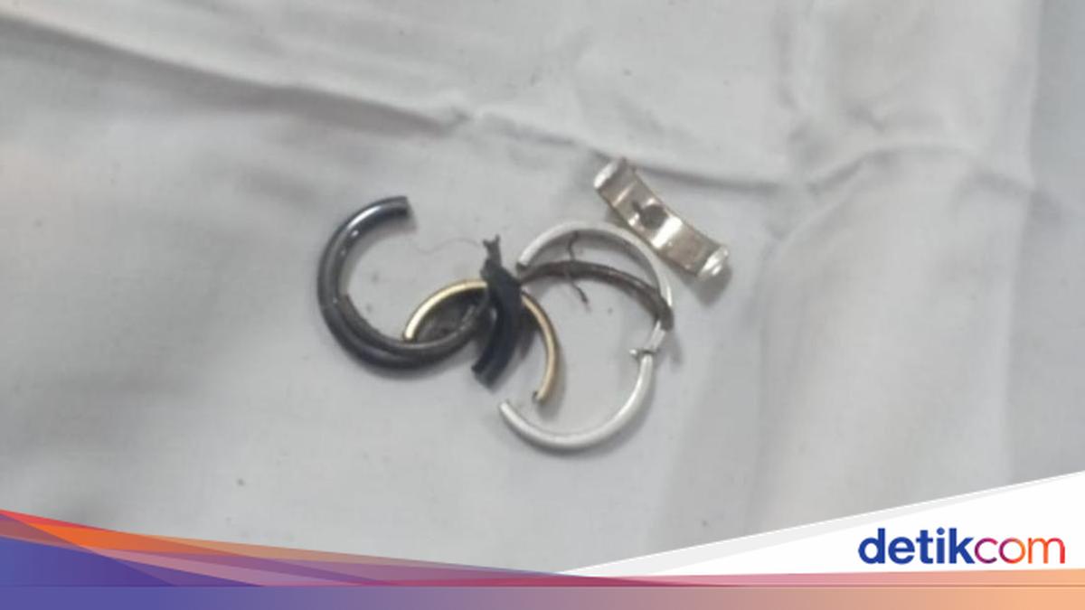 Indo Bokep Bikin Merinding, 4 Cincin Nyangkut di Kelamin Pria Ciamis