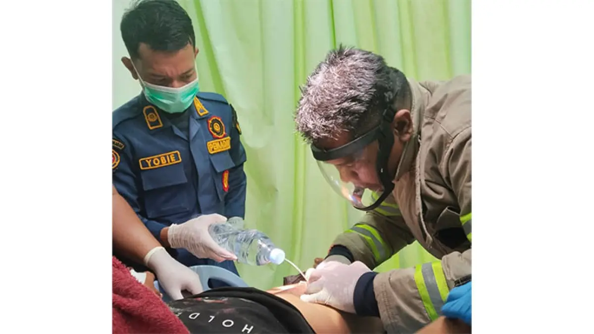 Indo Bokep cowok di Pekanbaru Minta Donasi Damkar Lepaskan Cincin di Kemaluan